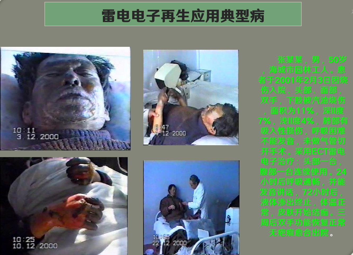 炁场疼痛治疗仪作用的核心因子